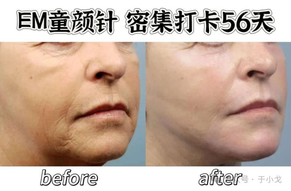 长胜证券 遭受了非人待遇，她终于杀回来了